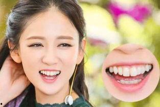 坏牙明星网红叫什么,揭秘明星网红的牙齿护理秘籍